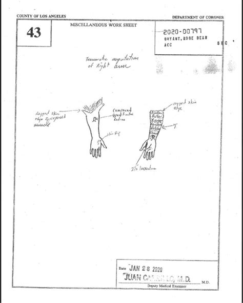 gigi kobe autopsy|Kobe Bryant Autopsy Report Is Released After。